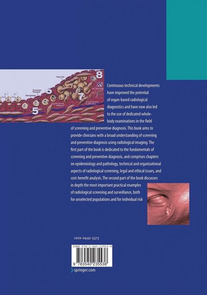 Produktbild: Screening and Preventive Diagnosis with Radiological Imaging