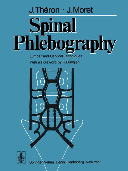 Produktbild: Spinal Phlebography