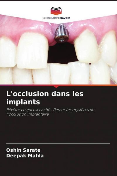 Produktbild: L'occlusion dans les implants