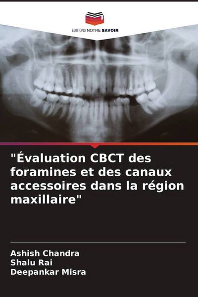 Produktbild: "&Eacute;valuation CBCT des foramines et des canaux accessoires dans la r&eacute;gion maxillaire"