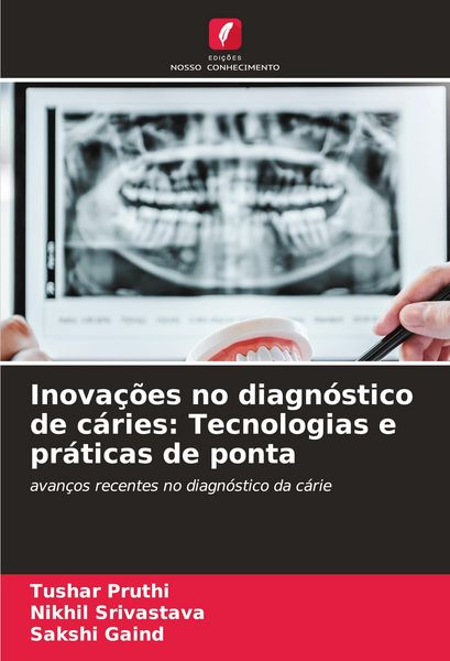 Produktbild: Inova&ccedil;&otilde;es no diagn&oacute;stico de c&aacute;ries: Tecnologias e pr&aacute;ticas de ponta