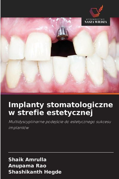 Produktbild: Implanty stomatologiczne w strefie estetycznej