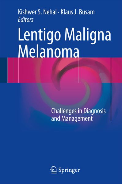 Produktbild: Lentigo Maligna Melanoma