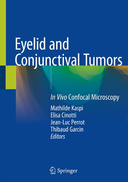 Produktbild: Eyelid and Conjunctival Tumors