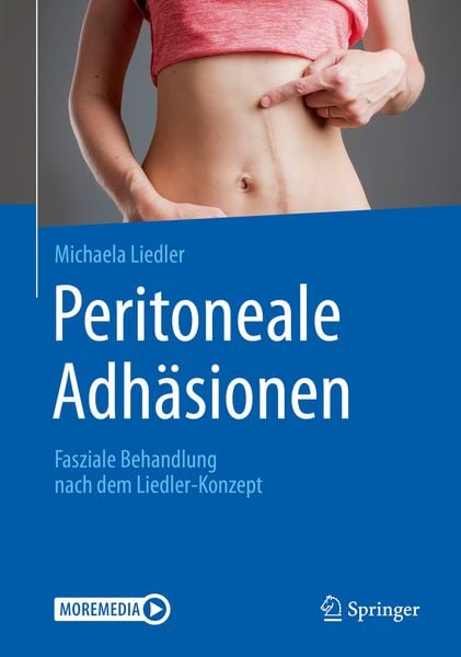 Peritoneale Adhäsionen, Taschenbuch von Michaela Liedler, Springer Berlin, 9783662604991