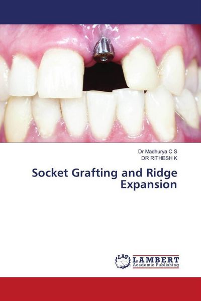 Produktbild: Socket Grafting and Ridge Expansion
