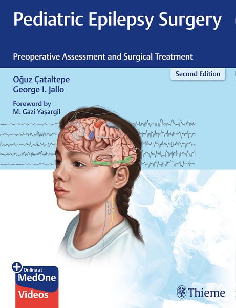 Produktbild: Pediatric Epilepsy Surgery