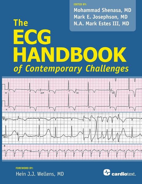 Produktbild: ECG Handbook of Contemporary Challenges