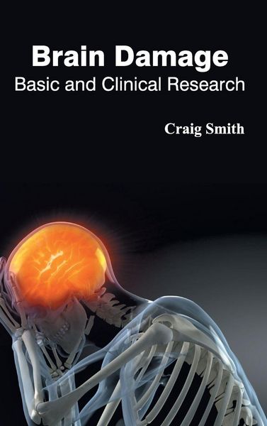 Produktbild: Brain Damage