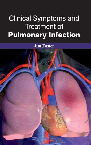 Produktbild: Clinical Symptoms and Treatment of Pulmonary Infection