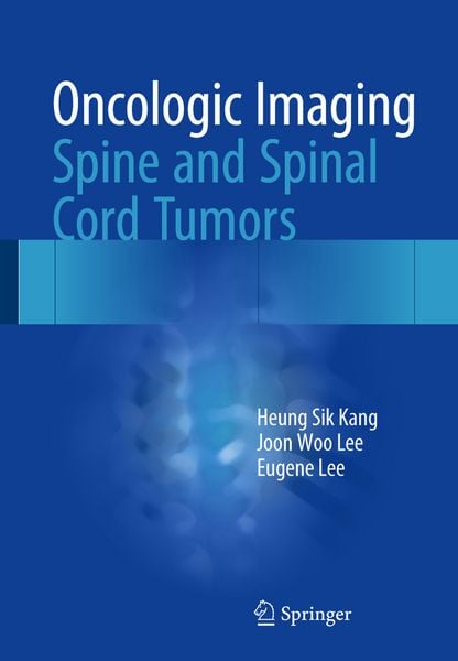 Produktbild: Oncologic Imaging: Spine and Spinal Cord Tumors