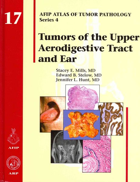 Produktbild: Mills, S: Tumors of the Upper Aerodigestive Tract and Ear