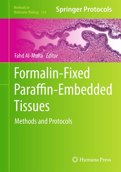 Produktbild: Formalin-Fixed Paraffin-Embedded Tissues