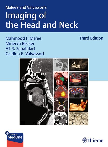 Produktbild: Mafee's and Valvassori's Imaging of the Head and Neck