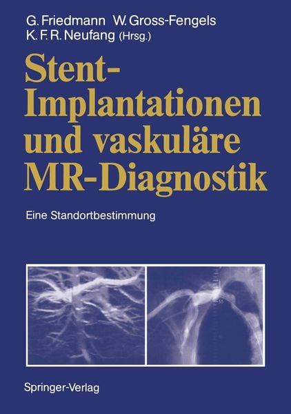 Produktbild: Stent-Implantationen und vaskul&auml;re MR-Diagnostik