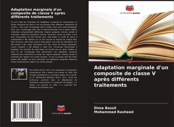 Produktbild: Adaptation marginale d'un composite de classe V apr&egrave;s diff&eacute;rents traitements