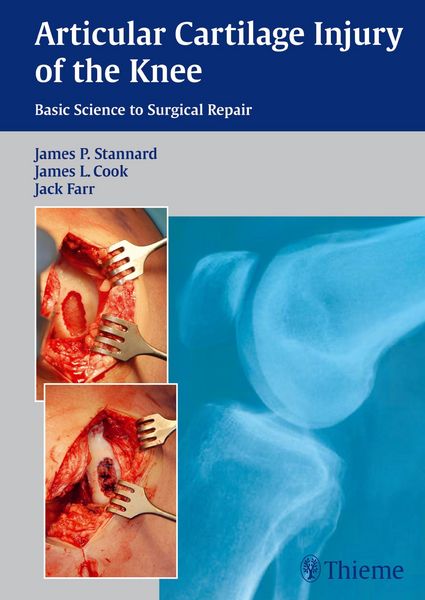 Produktbild: Articular Cartilage Injury of the Knee: Basic Science to Surgical Repair