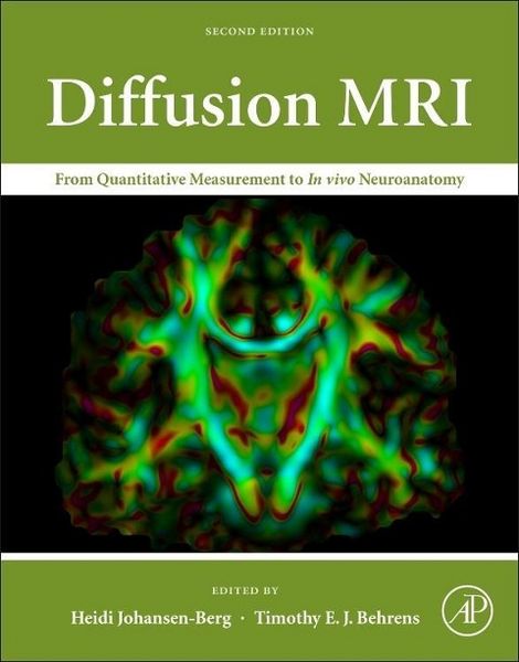 Produktbild: Diffusion MRI