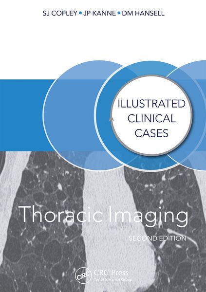 Produktbild: Thoracic Imaging
