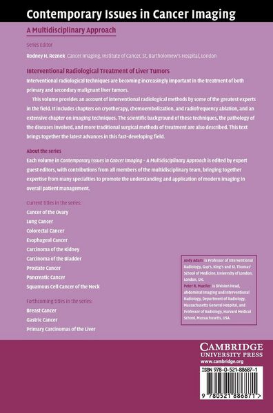 Produktbild: Interventional Radiological Treatment of Liver Tumors