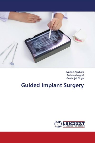 Produktbild: Guided Implant Surgery