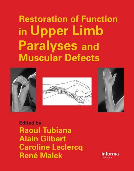 Produktbild: Restoration of Function in Upper Limb Paralyses and Muscular Defects