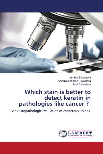 Produktbild: Which stain is better to detect keratin in pathologies like cancer ?