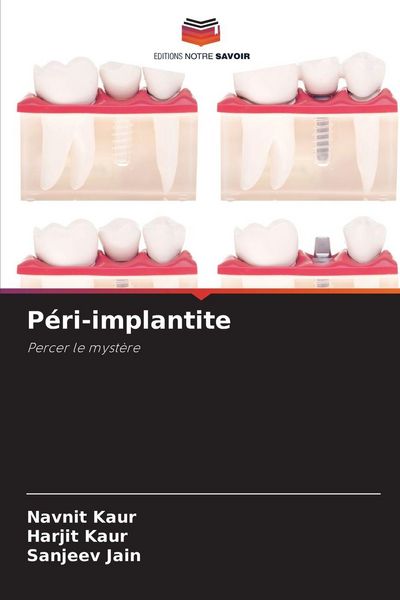 Produktbild: P&eacute;ri-implantite