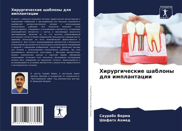 Produktbild: Hirurgicheskie shablony dlq implantacii