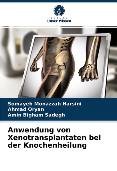Produktbild: Anwendung von Xenotransplantaten bei der Knochenheilung