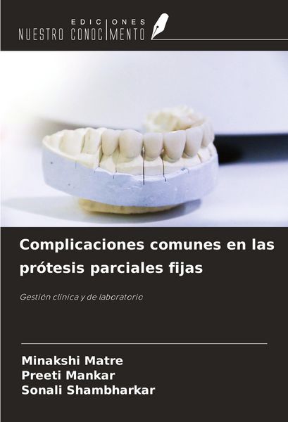 Produktbild: Complicaciones comunes en las pr&oacute;tesis parciales fijas