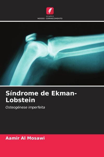Produktbild: S&iacute;ndrome de Ekman-Lobstein