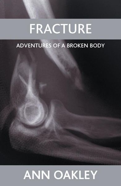 Produktbild: Fracture