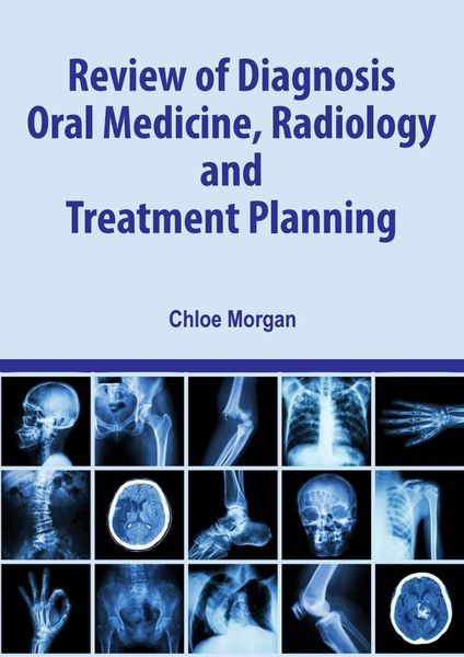 Produktbild: Review of Diagnosis, Oral Medicine, Radiology, and Treatment Planning