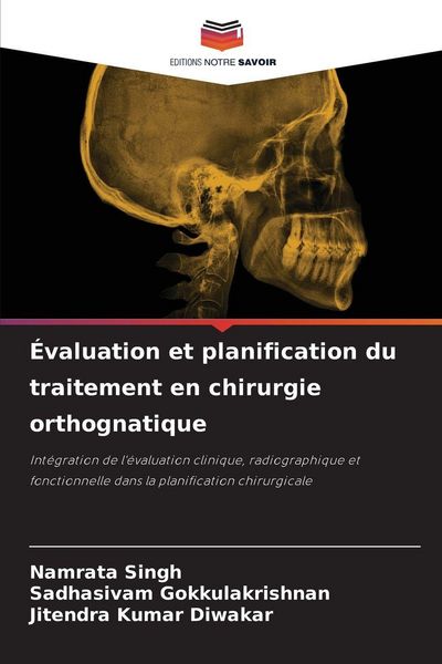 Produktbild: &Eacute;valuation et planification du traitement en chirurgie orthognatique