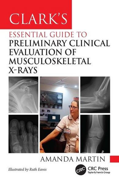 Produktbild: Clark's Essential Guide to Preliminary Clinical Evaluation of Musculoskeletal X-rays