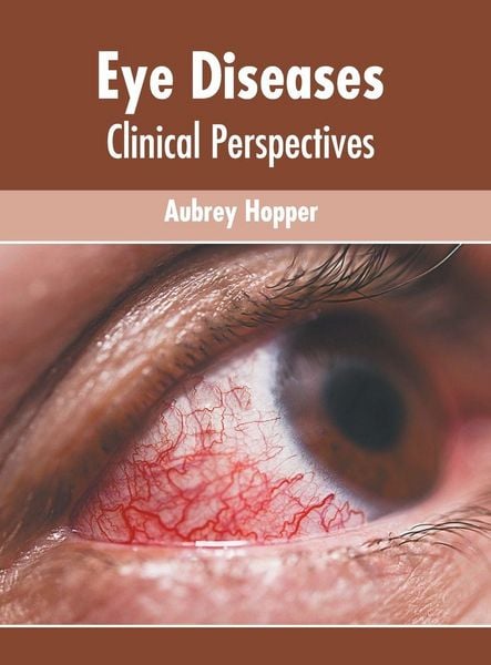 Produktbild: Eye Diseases