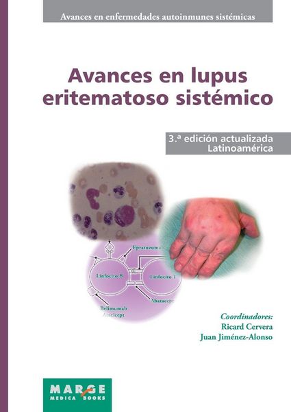 Produktbild: Avances en lupus eritematoso sist&eacute;mico - Latinoam&eacute;rica