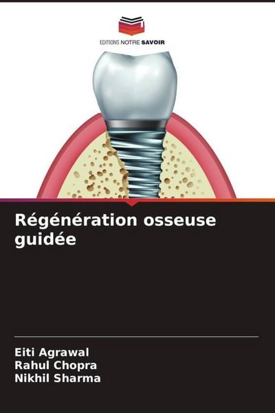 Produktbild: R&eacute;g&eacute;n&eacute;ration osseuse guid&eacute;e