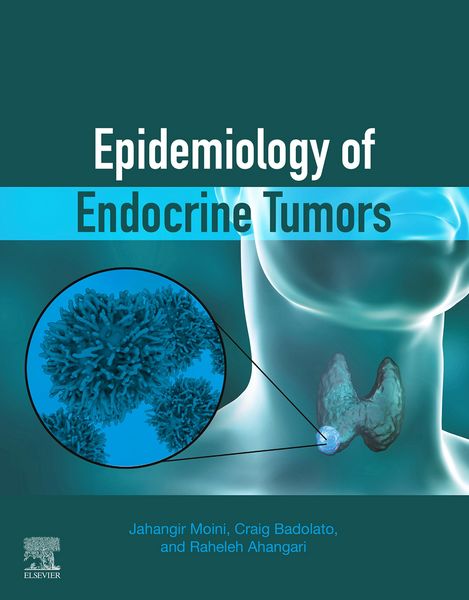 Produktbild: Epidemiology of Endocrine Tumors
