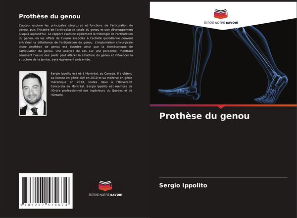 Produktbild: Proth&egrave;se du genou