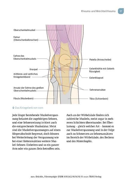 Produktbild: Fibromyalgie