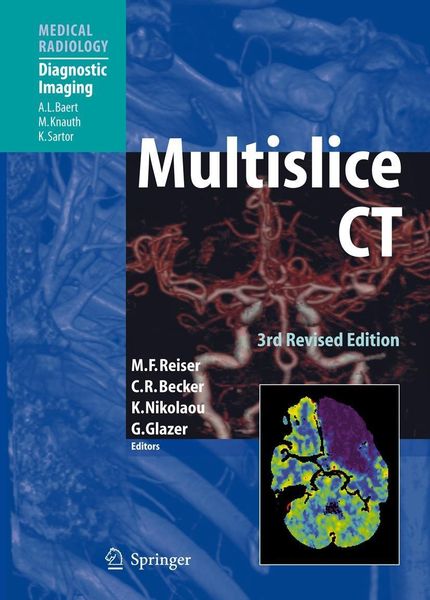 Produktbild: Multislice CT