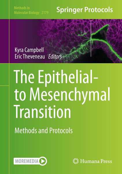 Produktbild: The Epithelial-to Mesenchymal Transition