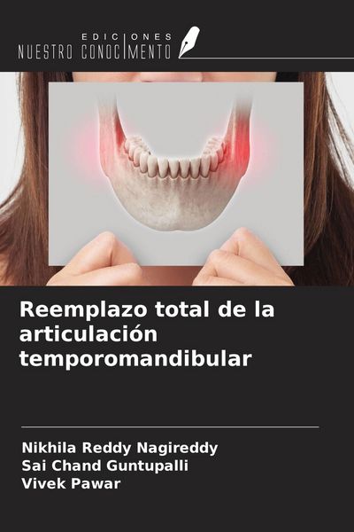 Produktbild: Reemplazo total de la articulaci&oacute;n temporomandibular