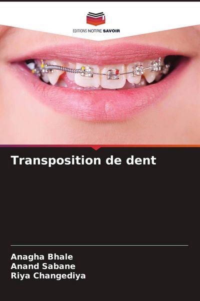 Produktbild: Transposition de dent