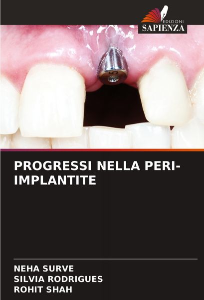 Produktbild: PROGRESSI NELLA PERI-IMPLANTITE