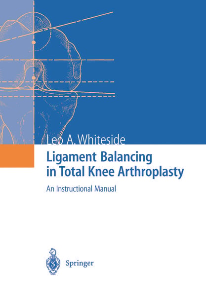 Produktbild: Ligament Balancing in Total Knee Arthroplasty