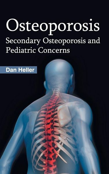 Produktbild: Osteoporosis