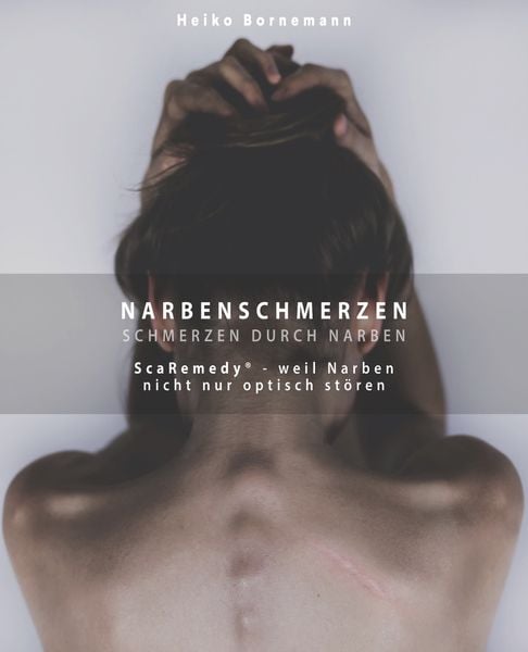 Produktbild: Narbenschmerzen - Schmerzen durch Narben
